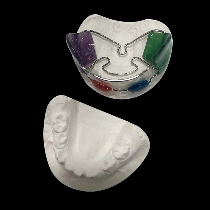 Frank Removable Denture